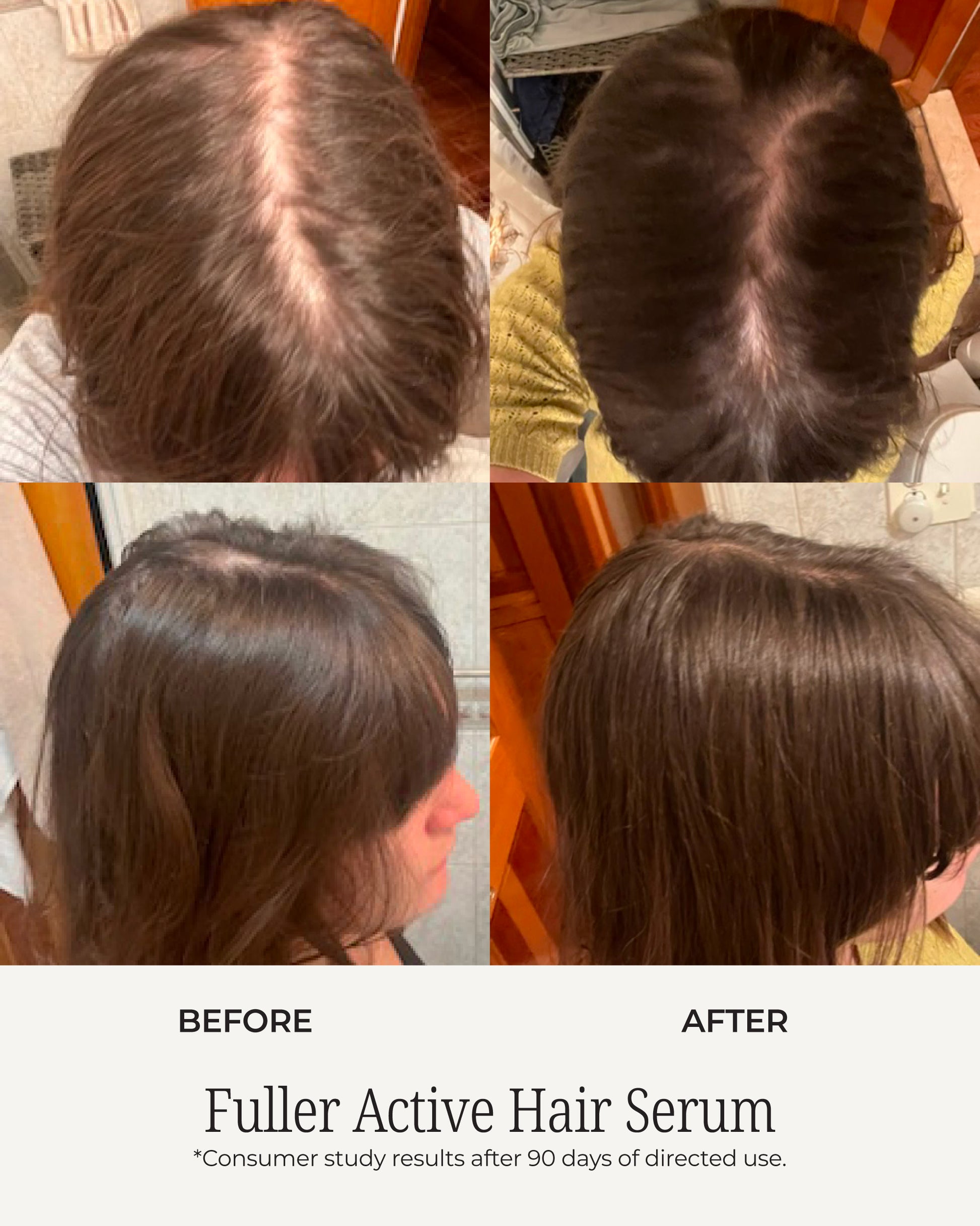 Before and after images of a person's hair showing improved fullness from LoveKyir Fuller Active Hair Serum