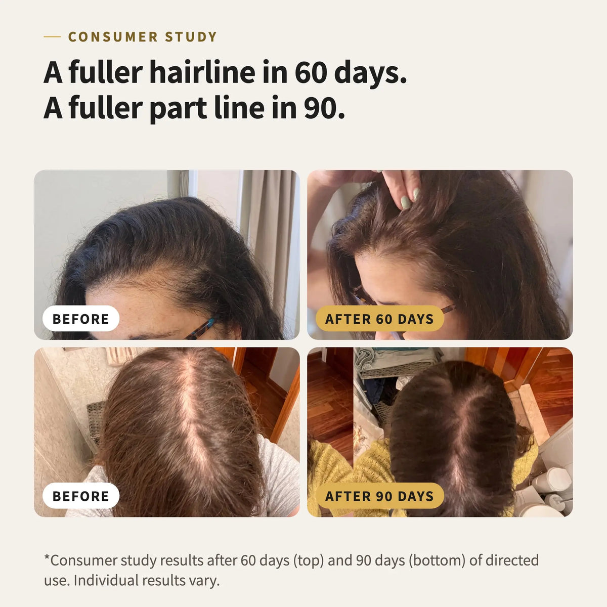 Before and after comparison of hair growth using LoveKyir Fuller Active Hair Serum