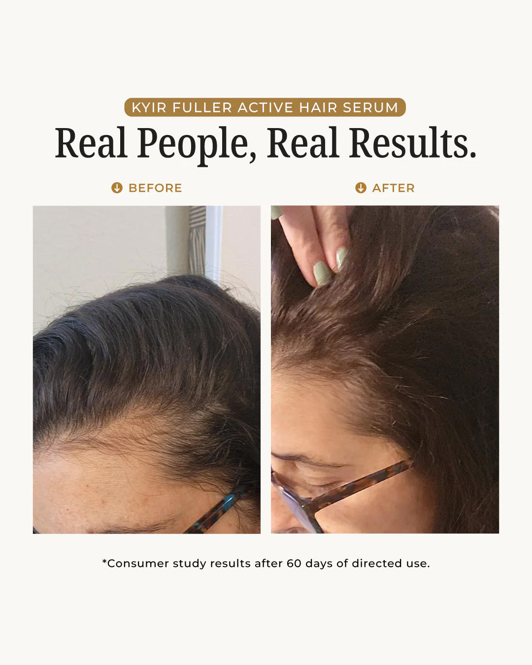 Fuller Active Hair Serum (3 Bottles - 90 Days)